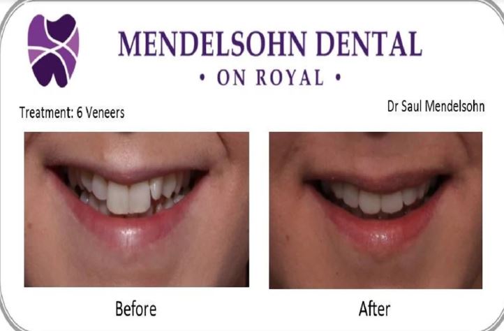 Mendelsohn Dental