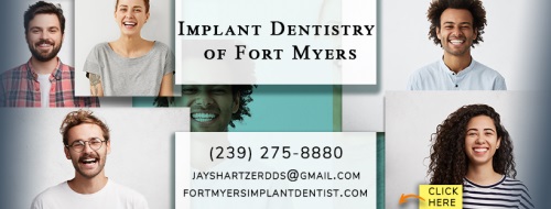 Dr. Jay Shartzer, Implant Dentistry