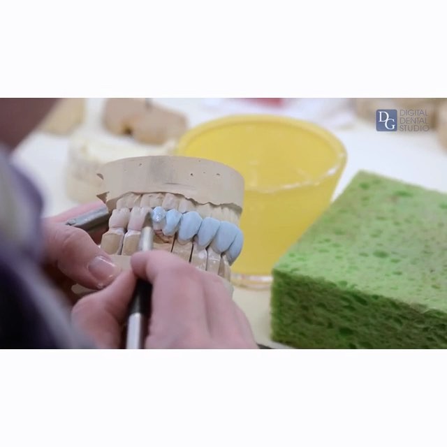 Abutmentdentalny Abutmentdentalny