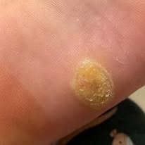 Podiatry Sydney CBD | Podiatry First