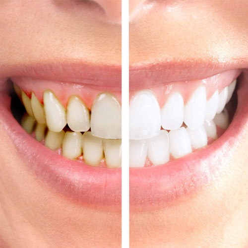 Cosmetic Dentist of East Flatbush