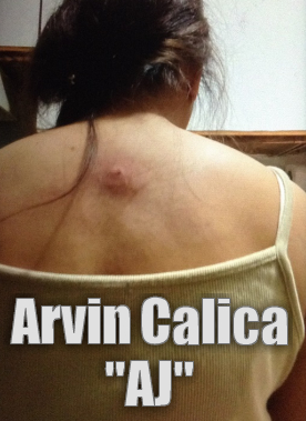 Arvin Calica Domestikong karahasan