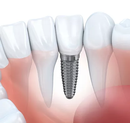 Conservation Dental Centre