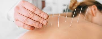Shona Campbell Acupuncture
