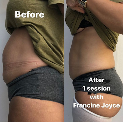  Francine Joyce - Cellulite Treatment
