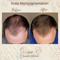 smpsouthafrica