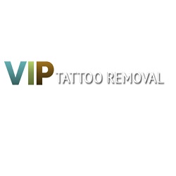 VIP Tattoo Removal
