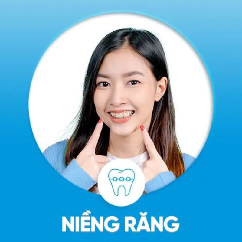 Dịch vụ niềng răng