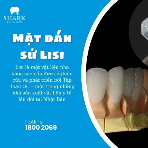 Răng sứ Lisi