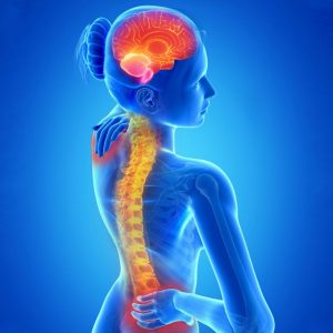 Visit Chiropractor for Migraines to Obtain Relief