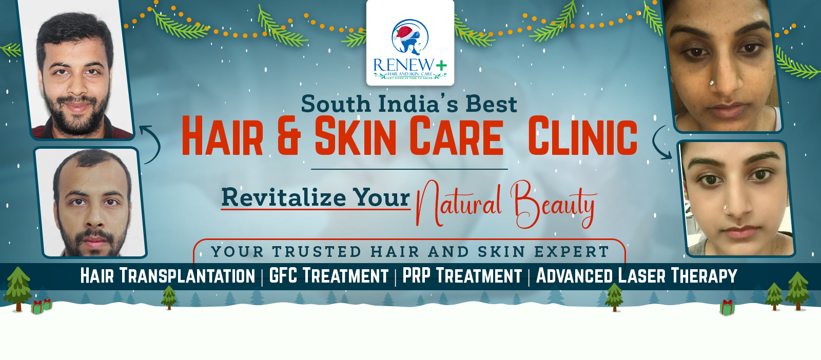Renew Plus Hair and Skin Care Coimbatore